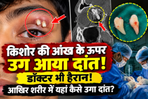OMG! बच्चे की आंख के ऊपर उग आया दांत, डॉक्टर भी हैरान! सर्जरी कर निकाला